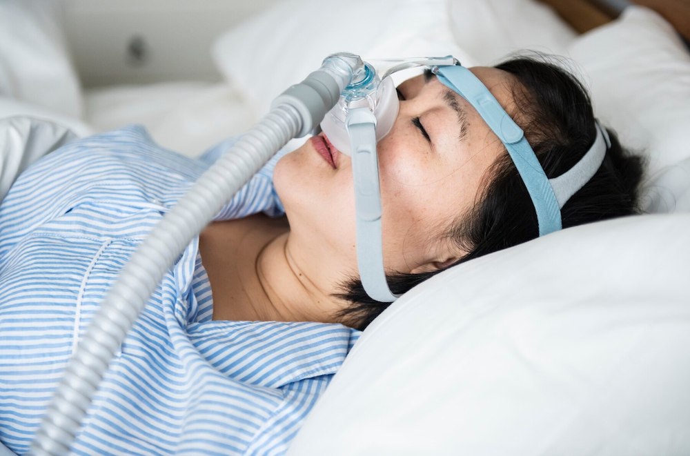 睡眠窒息