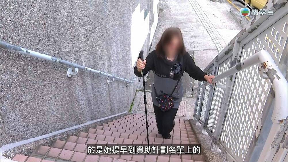 黃斑病變-東張西望