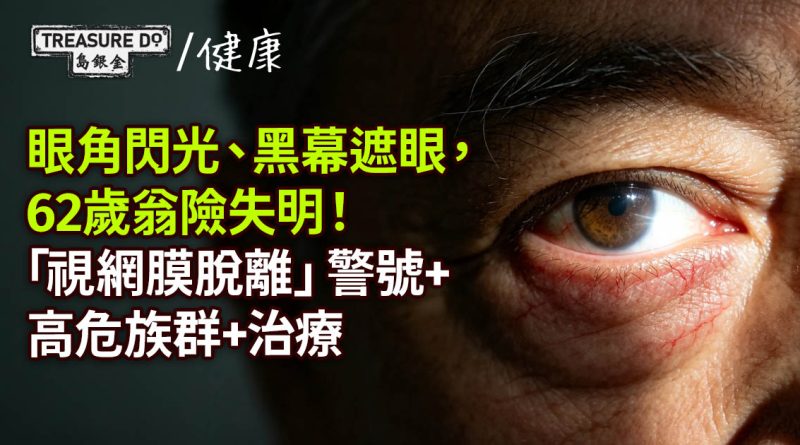 眼角閃光、黑幕遮眼,62歲翁險失明!「視網膜脫離」警號+高危族群+治療