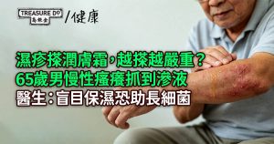 濕疹越搽潤膚霜越嚴重?65歲男慢性瘙癢抓到滲液 醫生:盲目保濕恐助長細菌